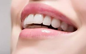 牙齿矫正与脸型 为什么牙齿矫正会改变脸型